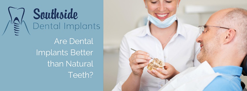 Do dental implants get gum disease? Do they feel like natural teeth? Can dental implant get cavities? Southside Dental Implants in South Brisbane have the answer...